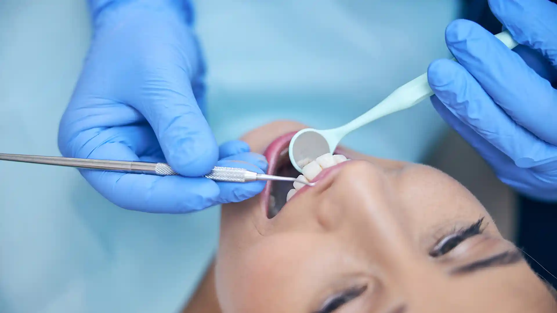 Do you shave teeth for veneers?